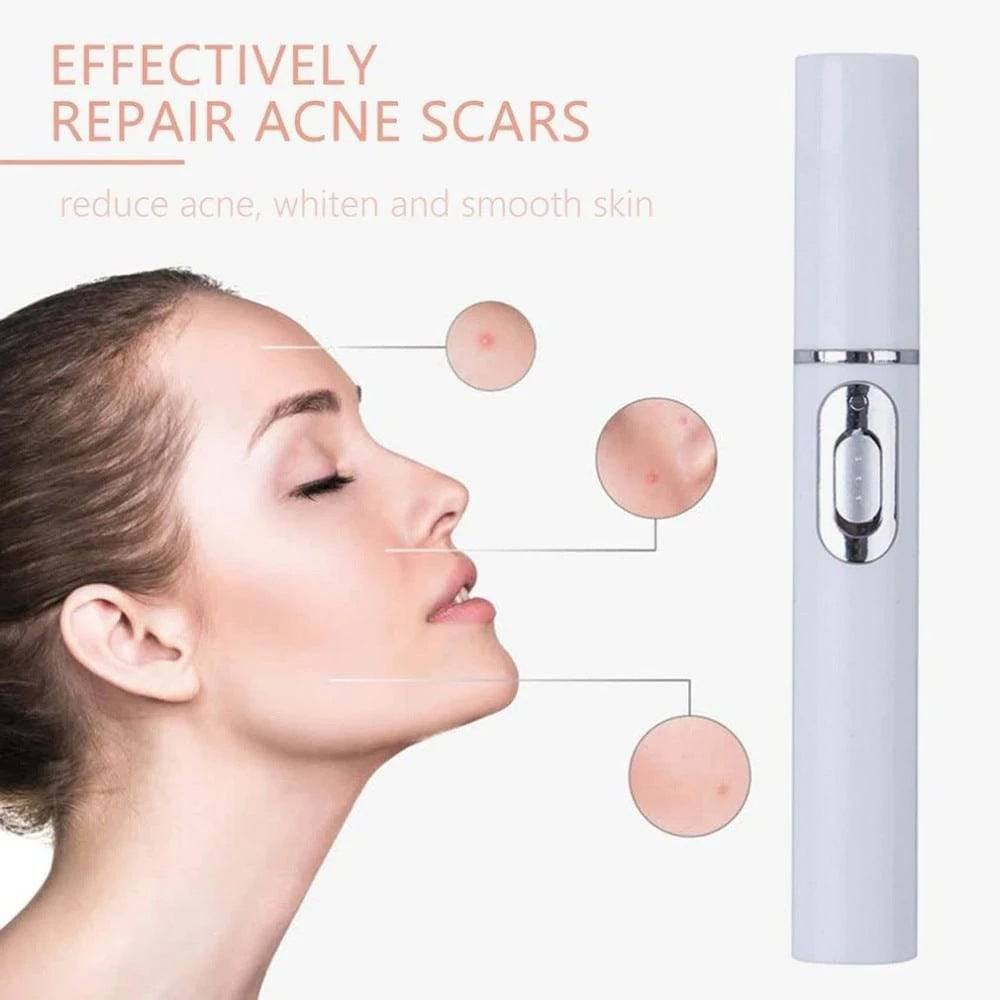 Blue Light Therapy Acne Laser Pen Soft Scar Wrinkle Removal Treatment Device Skin Care Beauty Equipment - YLORESHOP