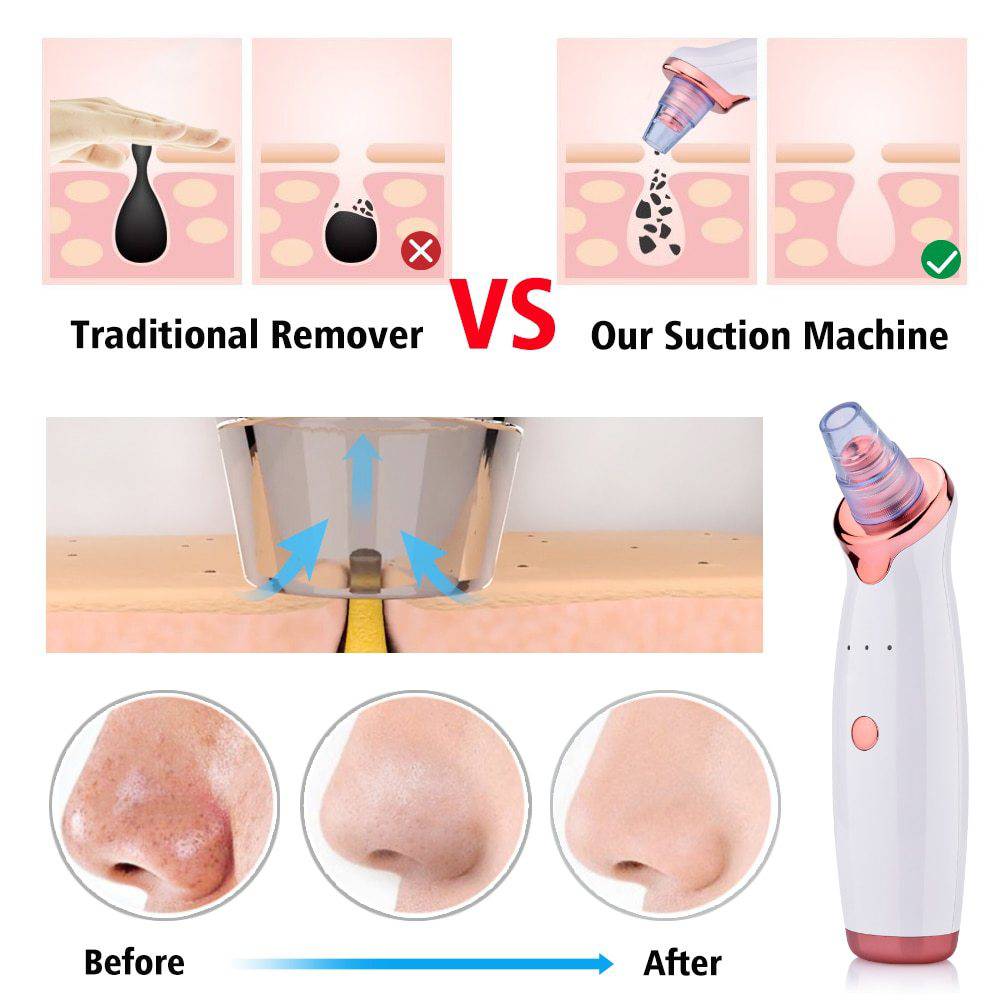 Blackhead Instrument Electric Suction Facial Washing Instrument Beauty Acne Cleaning Blackhead Suction Instrument - YLORESHOP