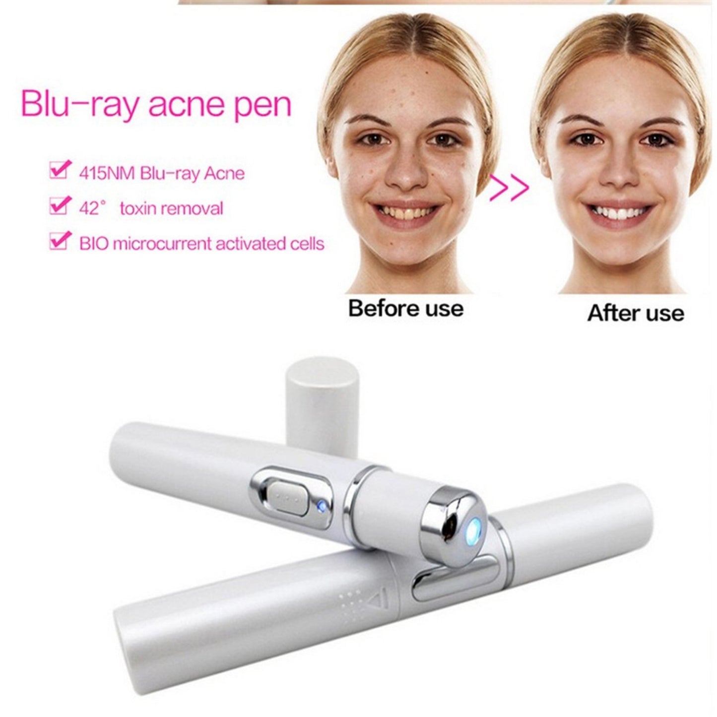 Blue Light Therapy Acne Laser Pen Soft Scar Wrinkle Removal Treatment Device Skin Care Beauty Equipment - YLORESHOP