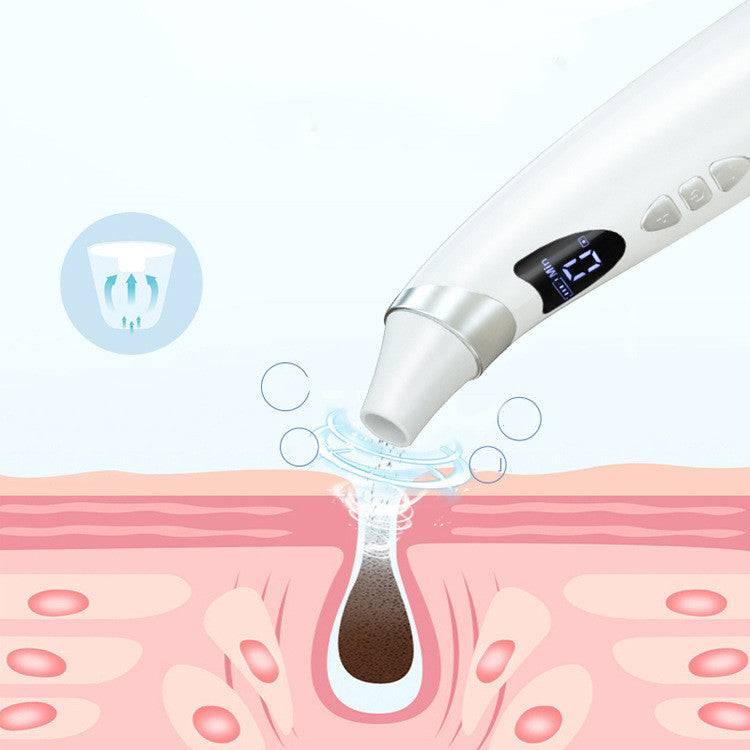 Electric Visual Blackhead Suction Instrument Household Cleansing Pore Cleaner For Skin Equipment Skin Care Tool - YLORESHOP