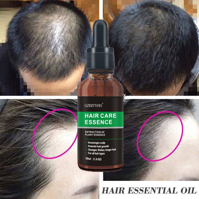 Hair Growth Oil Hair Growth Oil Oem Hair Care Essential Oil - YLORESHOP