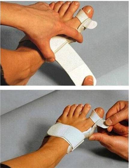 Hallux Valgus Corrector With Foot Valgus Separator - YLORESHOP