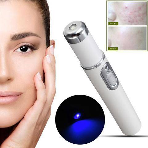 Blue Light Therapy Acne Laser Pen Soft Scar Wrinkle Removal Treatment Device Skin Care Beauty Equipment - YLORESHOP