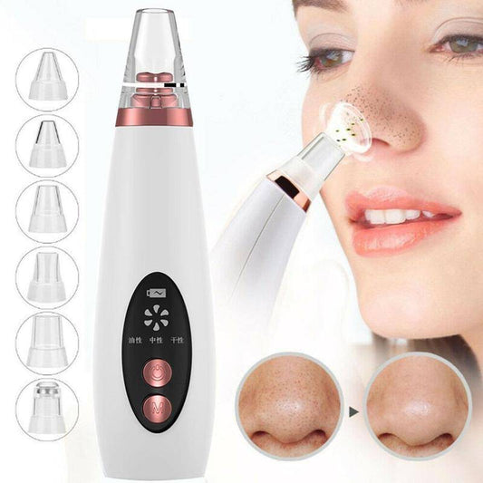 Blackhead Pore Vacuum Cleaner Nose Cleanser Blackheads Remover Blackhead Acne Removal Button Face Suction Beauty Skin Care Tool - YLORESHOP