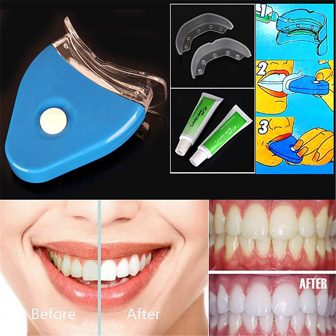 Oral Gel Teeth Tooth Whitening Whitener Dental Bleaching LED - YLORESHOP